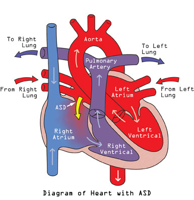 Blood circulation path scheme with arrows. Heart Diagrams Open Heart Surgery